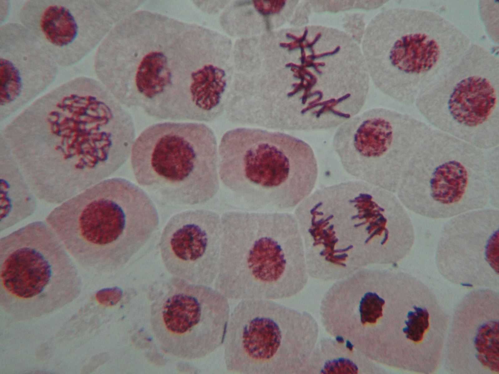 Hình 20.1b Tế bào rễ hành ở các kì quan sát được dưới kính hiển vi