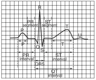 Các thành phần của điện tâm đồ với tiêu chuẩn sóng (P, Q, R, S, T, U), khoảng thời gian hữu ích và các phép đo khoảng cách bình thường